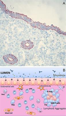 Uterine Immunity and Microbiota: A Shifting Paradigm